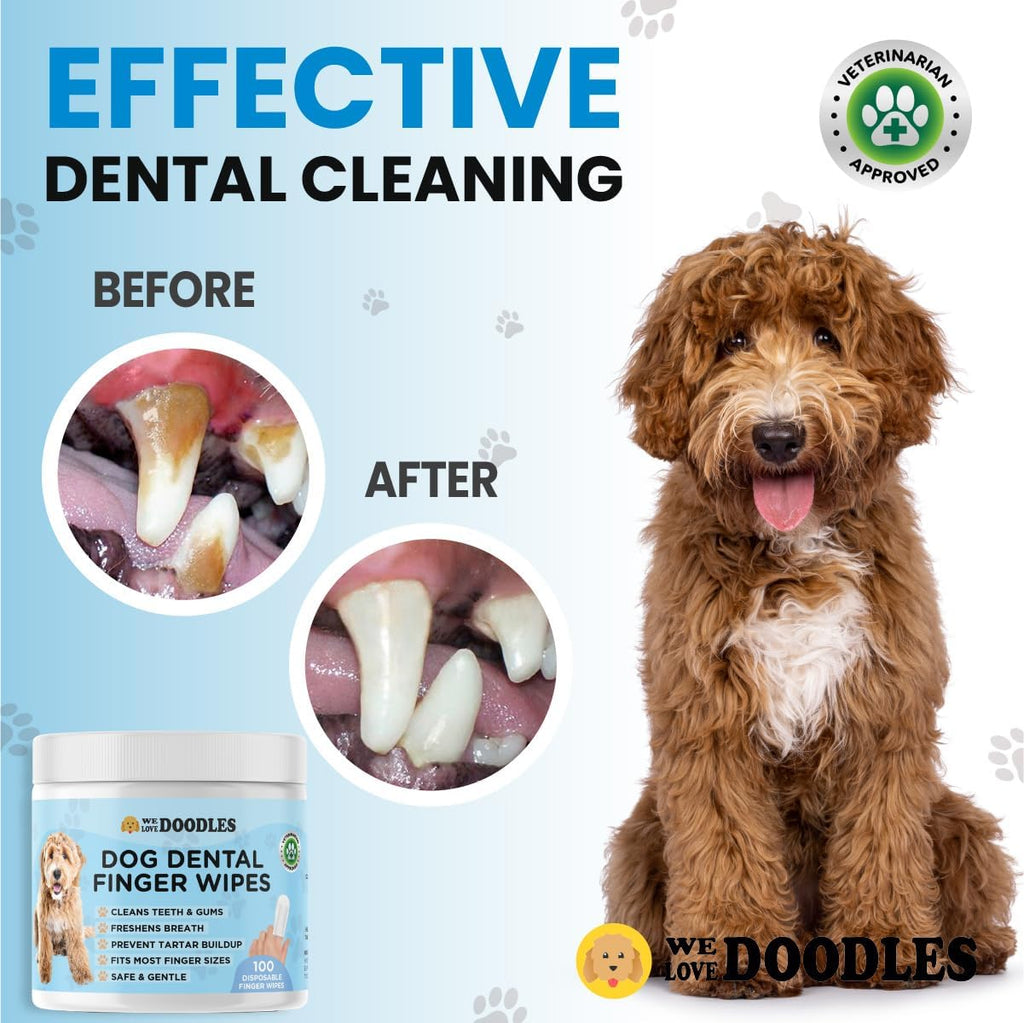Dog Dental Finger Wipes (100 PCS)
