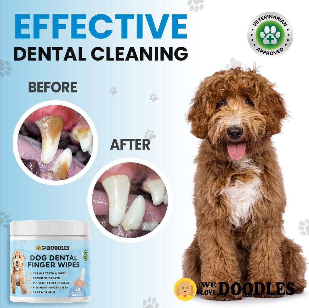 Dog Dental Finger Wipes (50 PCS)